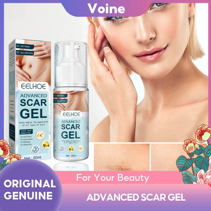 Eelhoe Scar Repair Gel Cream Pimples Scars Removal Gel Fade Stretch