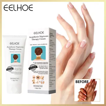 Buy Clear All Dark Knuckles Clear And Dark Spot Remover Carrot