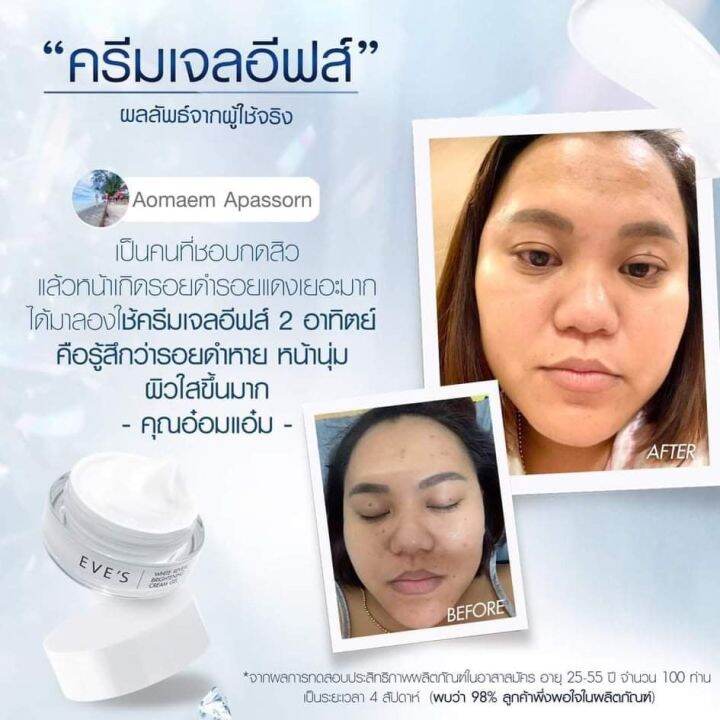 ส่งฟรี-เซตขายดี-เซตคู่-ขาวฟูเด้ง-x2-อีฟส์-ครีมบำรุงหน้าขาวใส-ลดรอยสิว-กระชับรูขุมขน-ครีมเจล-อีฟส์-เซรั่มไฮยา