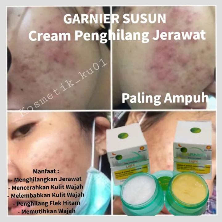 Cream Garnier Susun Siang Dan Malem Cream Siang Malem penghilang