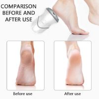 ZZOOI USB Rechargeable Portable Vacuum Adsorption Foot Grinder Electric Foot File Pedicure Tools Dead Skin Callus Remover Feet Sander