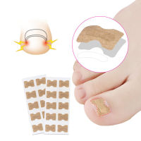 คุด Toenail Corrector สติกเกอร์เล็บ Strip Anti-ม้วนเล็บฟรีกาว Toe Inlay Nail Corrector Patch Correction สติกเกอร์ Toenail