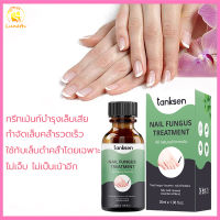 EELHOE เซรั่มบำรุงเล็บ หยดซ่อมเล็บเสีย  30ml บำรุงเล็บ ลากับเล็บเสีย บำรุงเล็บมือ/เท้า การดูแลเล็บ ห่างกับปัญหาเล็บ เชื้อราเล็บ( น้ำยารักษาเล็บ เซรั่มเล็บ เชื้อราเล็บ บำรุงเล็บน้ำมันบำรุงเล็บ ดูแลเล็บ ครีมบำรุงซ่อมแซมเล็บ เซรั่มทาเล็บ เชื้อราเล็บ)