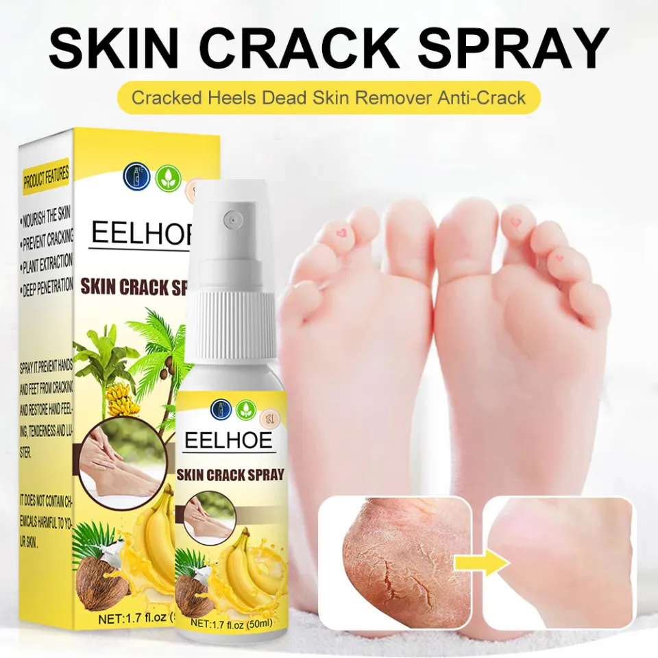 Anti-Drying Natural Banana Dead Skin Remover Soften Skin Crack