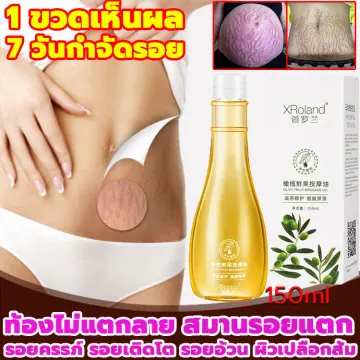 ครีมแก้ขาลายเด็ก ราคาถูก ซื้อออนไลน์ที่ - ก.ค. 2023 | Lazada.co.th ครีมแก้ขาลายเด็ก ราคาถูก ซื้อออนไลน์ที่ - ก.ค. 2023 | Lazada.Co.Th
