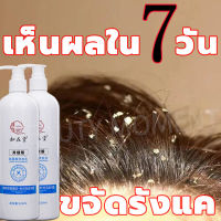 ⚡สินค้าขายดี⚡ยาสระผมแก้เชื้อรา 520ml สูตรเกลือทะเลธรรมชาติ บรรเทาอาการคันหนังศีรษะและทำความสะอาดหนังศีรษะ ยาสระผมรังแค ยาสระผมเชื้อรา แชมพูขจัดรังแค แชมพูไม้วอร์มวูด แชมพูรักษารังแค แชมพูแก้รังแค แชมพูยาเชื้อรา แซมพูขจัดรังแค แชมพูพญายอ บำรุงหนังศรีษะ