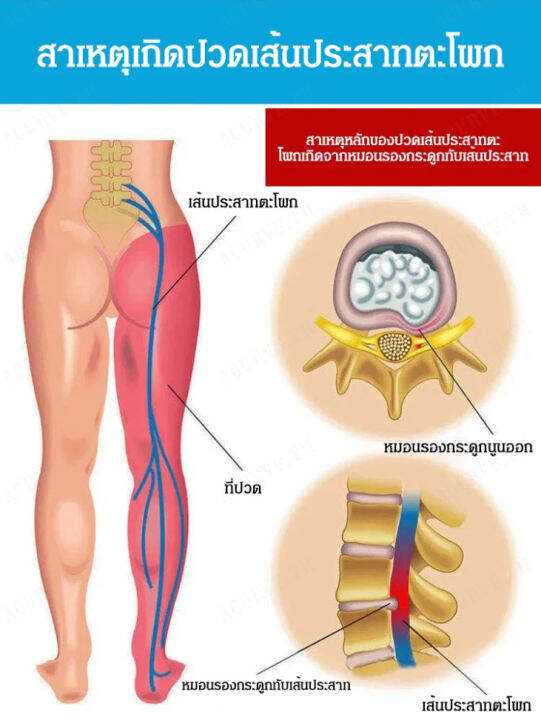 acurve-เข็มขัดแก้ไข-hfh-รองรับเอวและสะโพก-ปรับปรุงท่าเอว-บรรเทาอาการปวดหลังส่วนล่าง