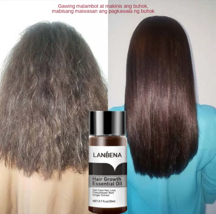 LANBENA Hair Care Essential Oil Quick Hair Growth Hair Care Essential Oil Treatment Hair Loss Prevent Hair Loss 20ml | Lazada PH LANBENA Hair Care Essential Oil Quick Hair Growth Hair Care Essential Oil Treatment Hair Loss Prevent Hair Loss 20ml | Lazada PH