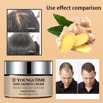 【cw】 2023 Hair Growth Cream Ginger Essence Serum Essential Oil Promotes Hair Regrowth Oil For Men Women 30g Hair Loss Liquid ！