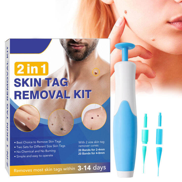 mus-double-ended-wart-remover-pen-set-painless-stem-warts-amp-mole-remover-set