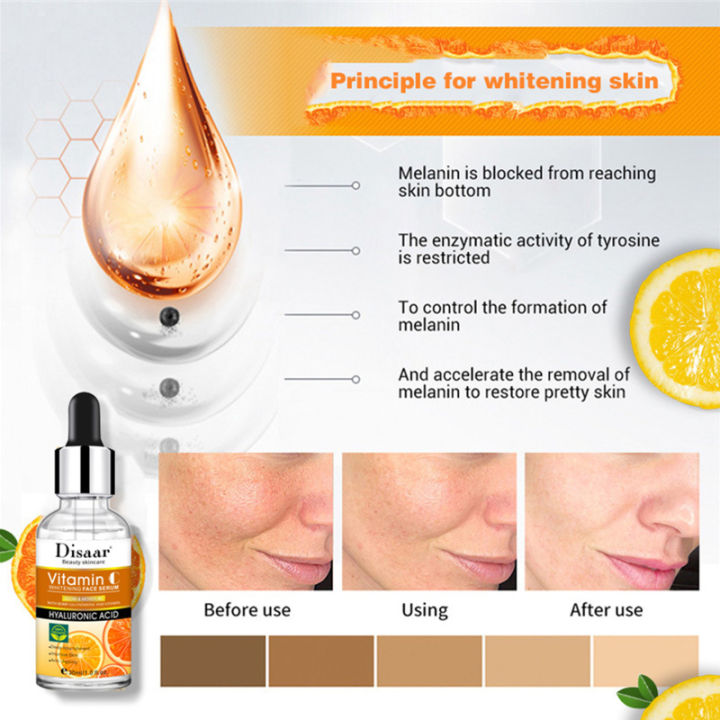 spring-breeze-vitamin-c-face-serum-30ml-skin-moisturizing-brightening-whitening-essence-dark-spot-remover-เครื่องสำอาง-face-care-product