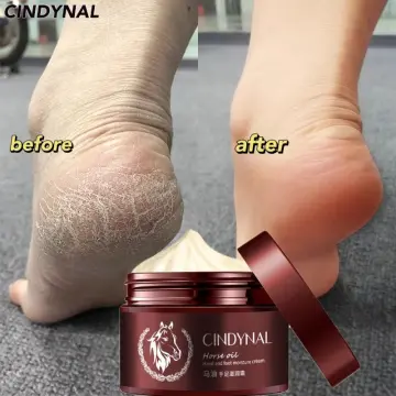 Shop Vaselyn Cream For Crack Heels with great discounts and prices online -  Jan 2024 | Lazada Philippines