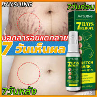 7 วันบอกลาท้องลาย JAYSUING 30ML สำหรับการซ่อมแซมผิวหลังคลอด รอยแตกลาย ร่องไขมัน ลดรอยแตกลาย หน้าท้องกระชับ ครีมทาขาแตกลาย ครีมแก้หน้าท้องลาย ครีมลดรอยแตก ครีมลดรอยแตกลาย ครีมทาหน้าท้อง ครีมทาเล็บเท้าลาย ครีมทาท้องลาย ครีมแก้แตกลาย