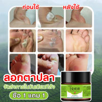 ลอกหูดตาปลา ขจัดติ่งเนื้อ ยาแต้มหูด ลอกหูดตาปลา ปลอดภัยไม่เจ็บตัว Corns warts prickles calluses flat removal cream 20g