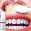 Hcmrtopr bọt tẩy trắng răng làm sạch răng khử mùi hôi miệng mousse teeth - ảnh sản phẩm 1