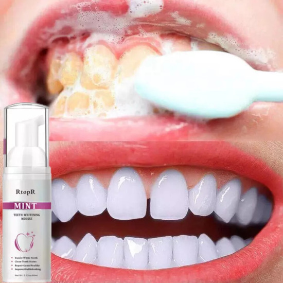 Hcmrtopr bọt tẩy trắng răng làm sạch răng khử mùi hôi miệng mousse teeth - ảnh sản phẩm 5
