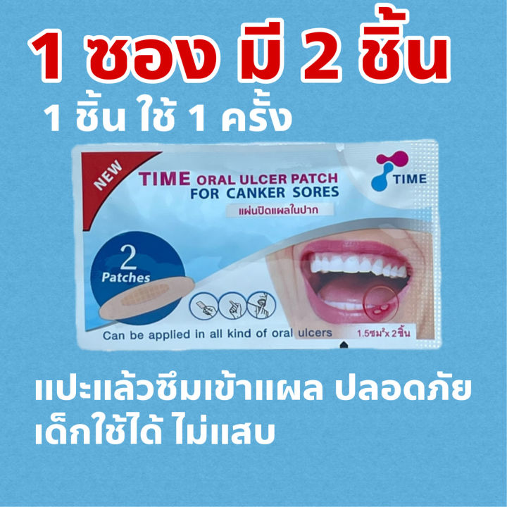 time-oral-ulcer-patch-ไทม์-แผ่นแปะร้อนใน-ซองละ-2-ชิ้น-1-ซอง