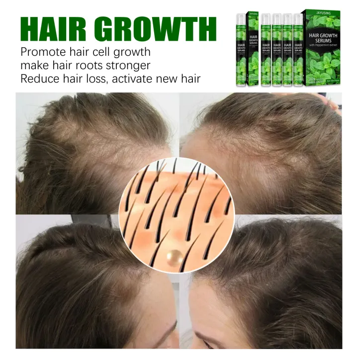Jaysuing Hair Growth Serums Hair Growth Essence Hair Loss Treatment Serum Nourish  Roots Fast Germinal Hair Care for Men Wome | Lazada PH
