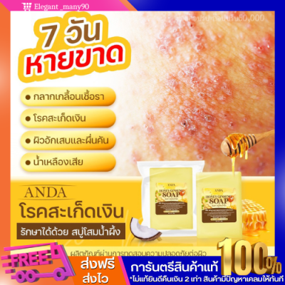 พร้อมส่ง!! สบู่โสมน้ำผึ้ง ANDA โรคสะเก็ดเงิน โรคผิวหนังคับ กลากเกลื้อน เชื้อรา น้ำเหลืองเสีย จบที่ก้อนเดียว หายขาด