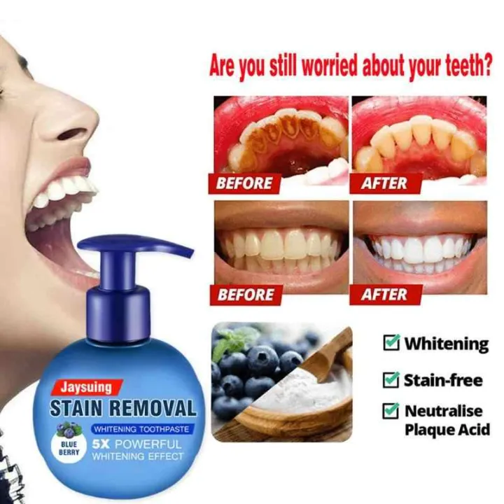 Baking Soda Whitening Toothpaste,Jaysuing Stain Removal Whitening Toothpaste Strengthening