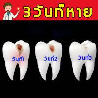 ✨ ขายดีญี่ปุ่น สารสกัดจากสมุนไพร✨ สเปรย์แก้ปวดฟัน (แก้ปวดฟัน/แก้ปวดฟันทันที/ยาสีฟันขจัดปูน/สเปรย์พ่นคอ/ยาเเก้ปวดฟัน/ รักษาโรคเหงือก/ปวดฟัน)สเปรย์ฉีดฟัน ยาแก้ปวดฟัน 1 ขวด 20ml。