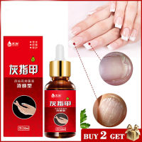 Nail Fungal Treatment Feet Care Essence Nail Foot Whitening Toe Nail Fungus Removal Gel Anti Infection Paronychia Onychomycosis