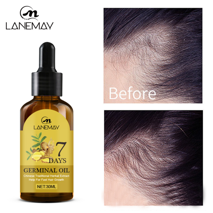 lanemay-hair-serum-เซรั่มบำรุงผม-30ml-1ขวด-เอสเซ้นส์ขิงบำรุงผม-กันร่วง-เซรั่มปกป้องผม-เซรั่มขิงปลูกผม-น้ำยาปลูกผม-บำรุงผม-เซรั่มปลูกผม-ป้องกันผมร่วง-น้ำยาเร่งผมยาว-แชมพูปลูกผมดก-เซรั่มใส่ผม-สเปรย์ปลูก