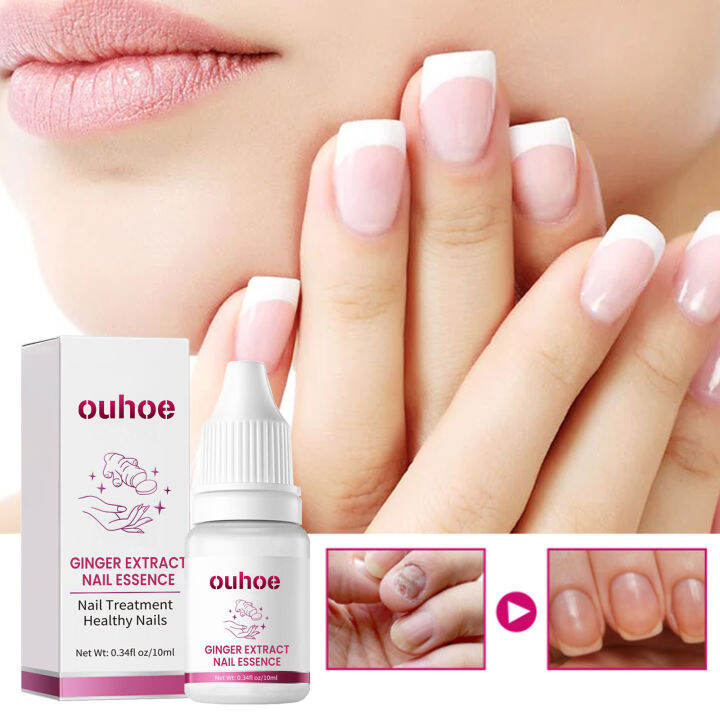 Ouhoe Nail Fungal Treatment Serum Anti Infection Paronychia