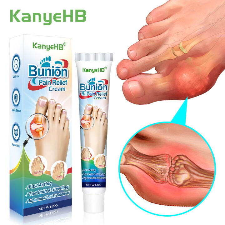 【CW】Joint Pain Ointment Toe Valgus Pain Relieve Cream Hand Wrist Thumb ...