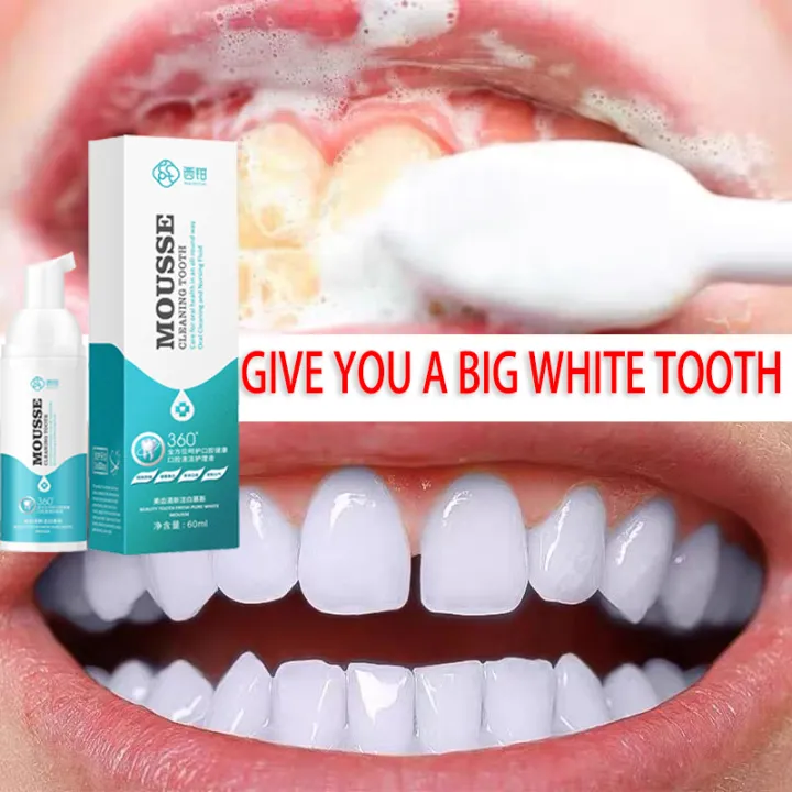 Quickly whiten teeth, tooth whitening essence gel, dental oral hygiene