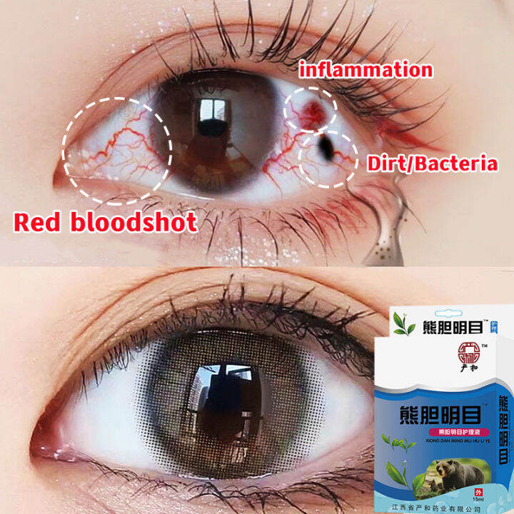 Healthy eye care eye drops, blurred vision eye drops, prevent eye