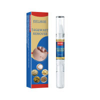 youyuanbai2 3มล.การกำจัดกับ moles genital wart Treatment จาก Skin Tags Remover