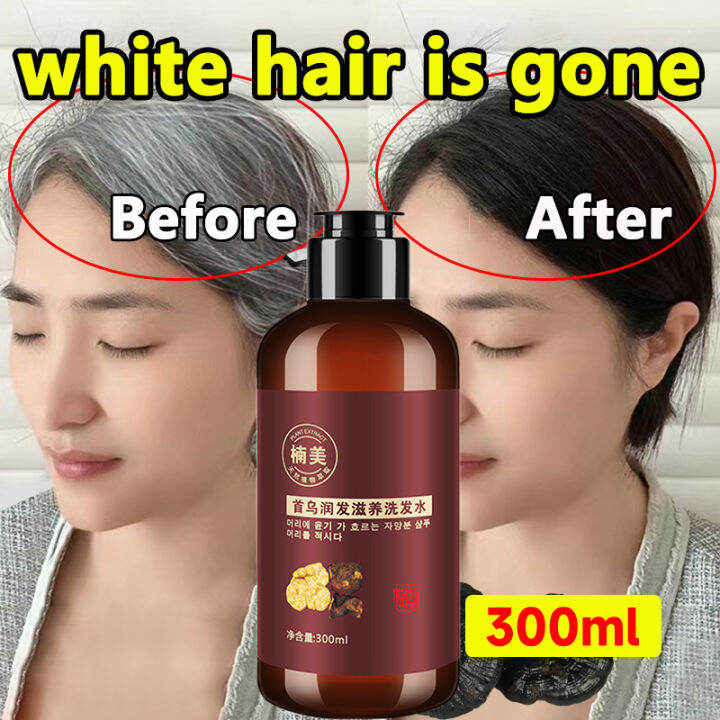Anti Stripping Shampoo Herbal Natural Polygonum Multiflorum Shampoo