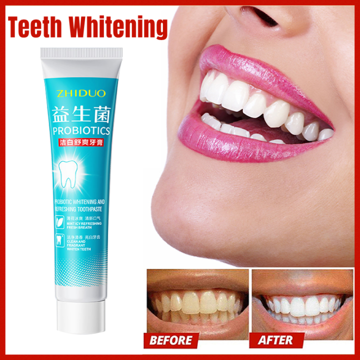 ZHIDUO Mint ice refreshing probiotic whitening toothpaste Probiotic ...