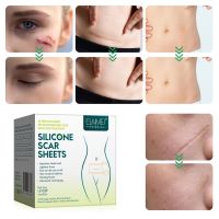 3 Meters/Roll Efficient Beauty Scar Removal Silicone Gel Self-Adhesive Silicone Gel Tape Patch for Acne Burn Scar Reduce in stock