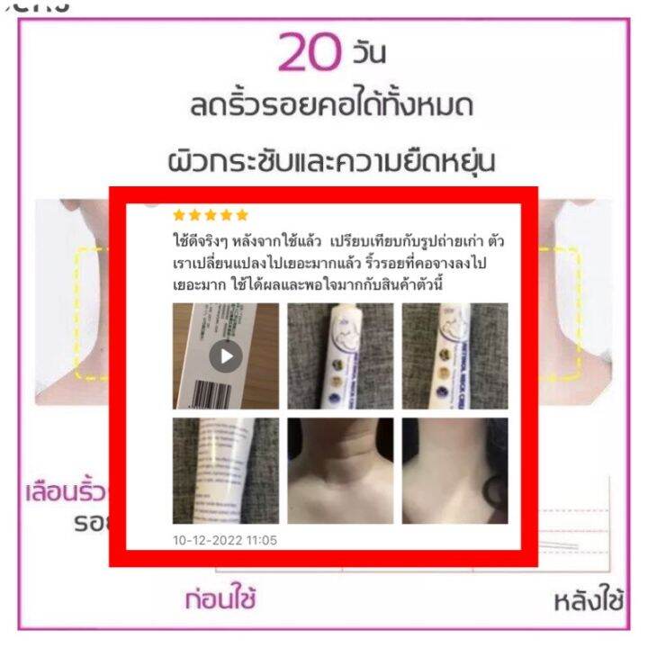 ส่งฟรี-ไวท์เทนนิ่งและกระชับผิวคอ-ครีมทาคอ-ครีมนวดกระชับคอ-ซ่อมแซมรอยเส้นที่คอ-ปรับปรุงริ้วรอย-ปรับรูปร่าง-ยกกระชับบริเวณลำคอ