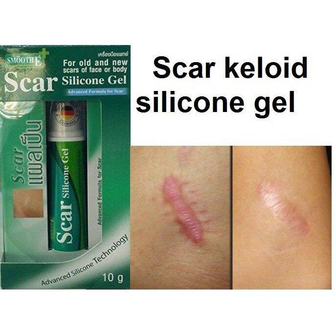 smooth-e-scar-silicone-gel-10g-ซิลิโคนเจลทารอยแผลเป็น