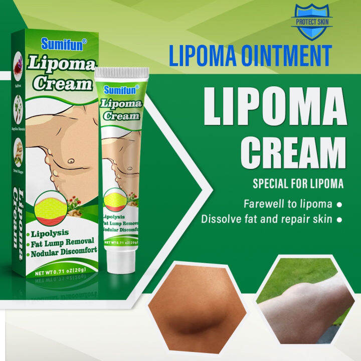 Sumifun Obat Benjolan Lipoma Salep Lipoma Cream Herbal Fibroid Benjolan