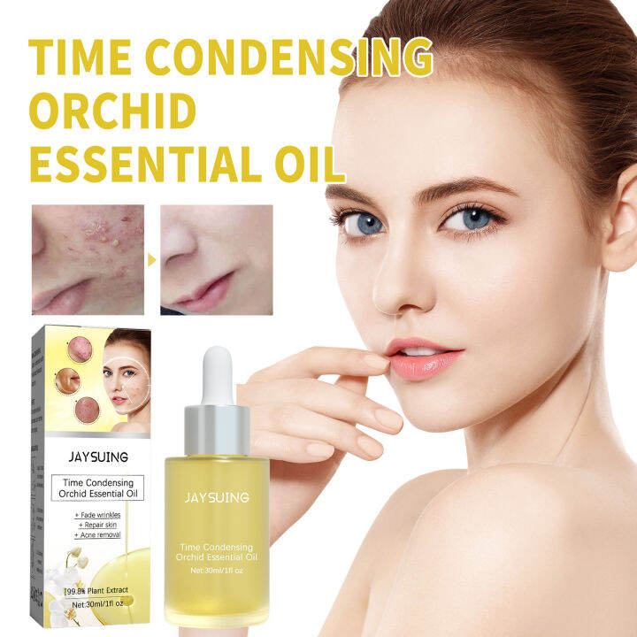 Orchid Acne Removing Essential Oil Pore Acne Cleanser Acne Marks Pox ...