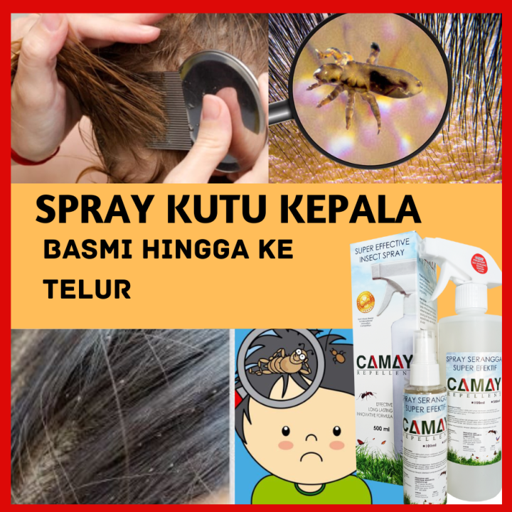 Spray Kutu Kepala Rambut Berkesan Camay Lazada