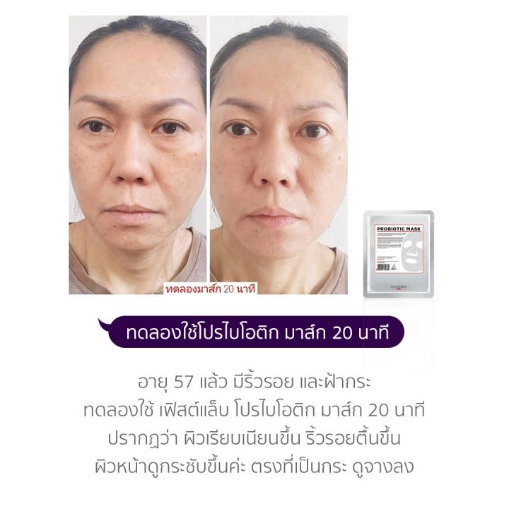 เฟิสต์แล็บ-โปรไบโอติก-มาส์ก-firstlab-probiotic-mask-1-แผ่น-มาส์กหน้า-มาส์กชีท-บำรุงเร่งด่วน-บูสความชุ่มชื้น-ผิวขาว-กระจ่างใส-ฟื้นฟูริ้วรอย-รอยดำ