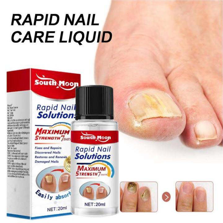 cuticle-and-nail-oil-nail-growth-repair-oil-mild-nail-cuticle-oil-for-hydrating-nail-hardener-nail-growth-polish-for-repair-nails-cuticles-feasible