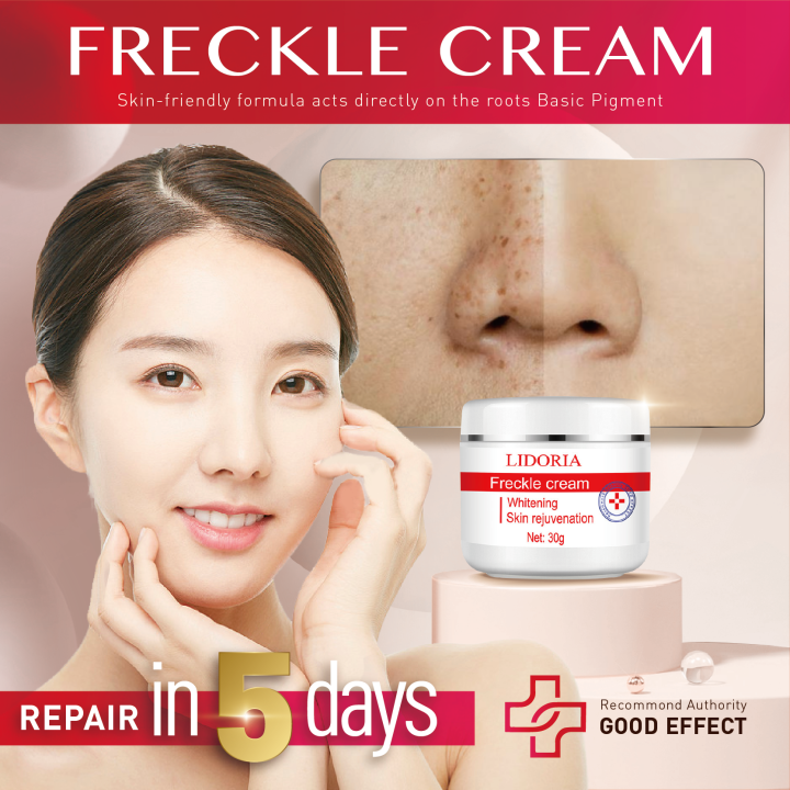 melasma and pekas remover cream original krina melasma pills tablet original serum for face