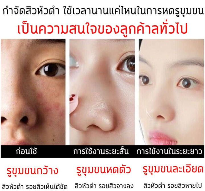 อัพเกรดใหม่-senana-ครีมล้างหน้า-น้ำยาทำความสะอาดผิวขาว-ครีมล้างหน้าผู้ชาย-กรดอะมิโนโฟมล้างหน้า-โฟมล้างหน้า-สะอาดหมดจด-ก-ทำความสะอาดอย่างอ่อนโยน-ทำความสะอาดล้ำลึก-ไม่ตึงหลังล้าง-ไม่ระคายเคือ-เหมาะเหมาะ