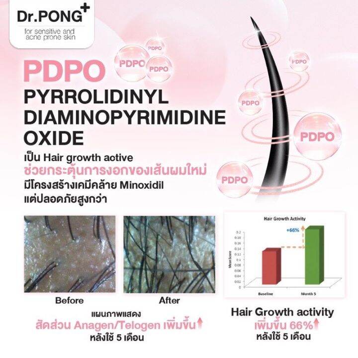 พร้อมส่ง-แชมพูลดผมร่วง-dr-pong-tsutsuji-gentle-shampoo-แชมพูลดผมร่วง-เพิ่มวอลุ่ม-anti-hairloss-shampoo