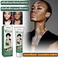 ?7วัน เห็นผล?South Moon ครีมทาด่างขาว 20g สารสกัดจากสมุนไพร ไม่ระคายเคือง ใช้ได้ทั้งร่างและทุกวัย ผลิตภัณฑ์กระตุ้นการสร้างเม็ดสีของผิว โรคด่างขาว โรคผิวหนัง ผลิตภัณฑ์ Vitiligo ด่างขาวที่หน้า ด่างขาวที่หลัง ด่างขาวที่แขน ด่างขาวที่ขา ยาด่างขาว