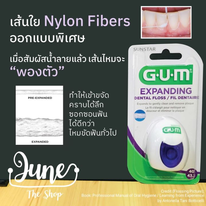 gum-expanding-dental-floss-2030c-ไหมขัดฟัน-ไหมพองตัวได้-ฟันห่างแค่ไหนก็ขจัดได้