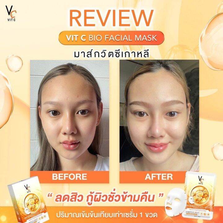 มาส์กวิตซีเกาหลี-vit-c-facial-mask-มาร์คน้องฉัตร-ผิวหน้ากระจ่างใส-วิตามินซีเข้มข้น-ลดสิว