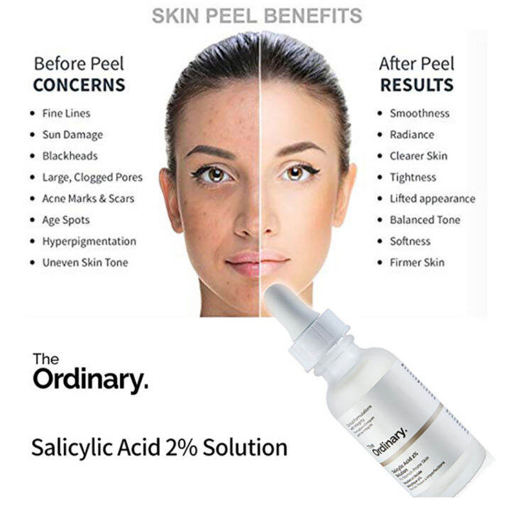 The Ordinary Salicylic Acid 2 Solution 30ml Lazada 8677