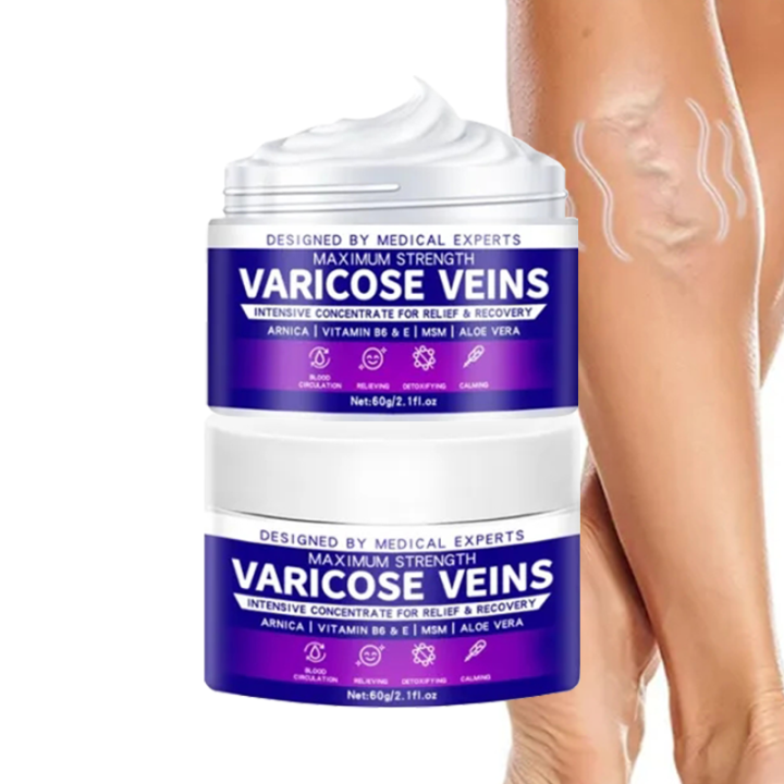 Varicose Essence Safe and Effective Varicose Vein Remover Treatment ...